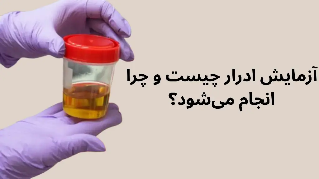 آزمایش ادرار چیست و چرا انجام میشود؟