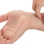 تست آلرژی