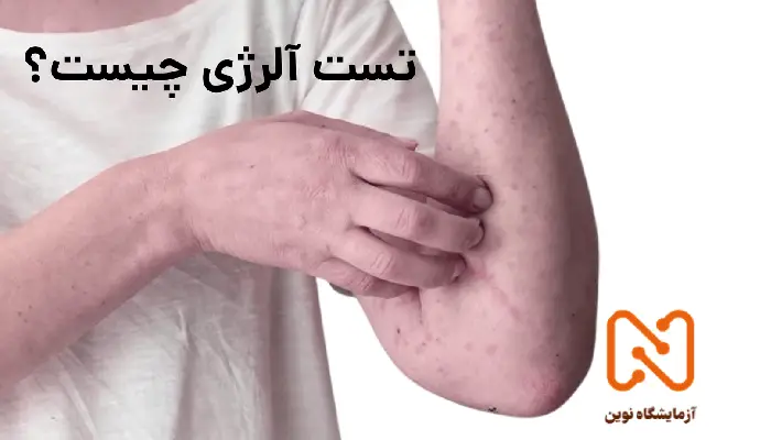 انواع تست آلرژی