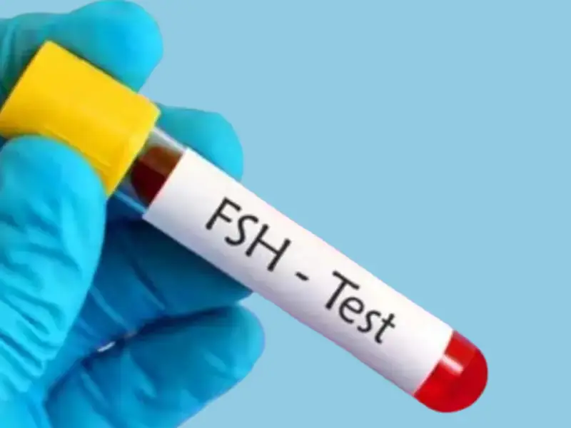آزمایش FSH