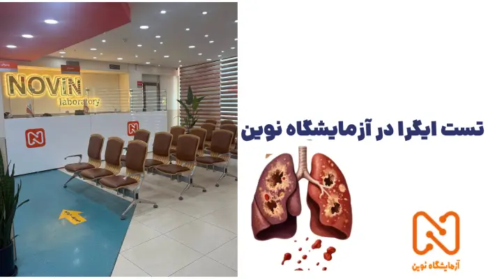 تست ایگرا در آزمایشگاه نوین