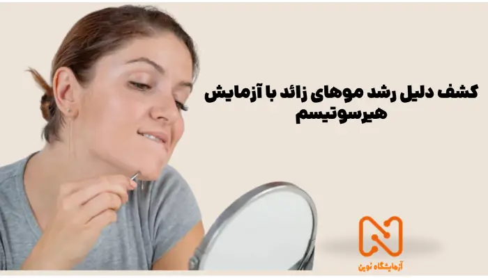 آزمایش هیرسوتیسم در قم
