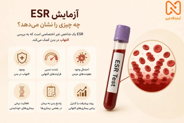 آزمایش ESR چه چیزی را نشان می دهد؟