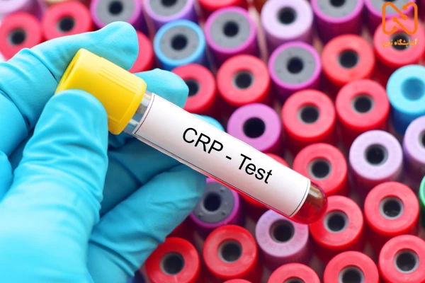 آزمایش CRP چیست