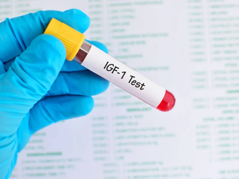 آزمایش IGF-1
